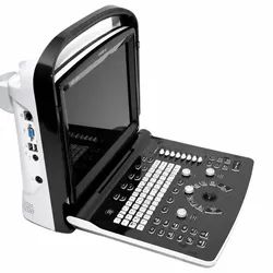 Chison ECO3 Expert Ultrasound