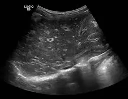 Periportal Cuffing