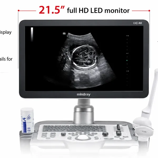 Mindray DC-30 Full HD Diagnostic Ultrasound System - Image 2