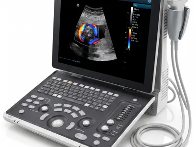 Mindray Z50 Portable Color Doppler