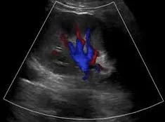 Renal vasculature